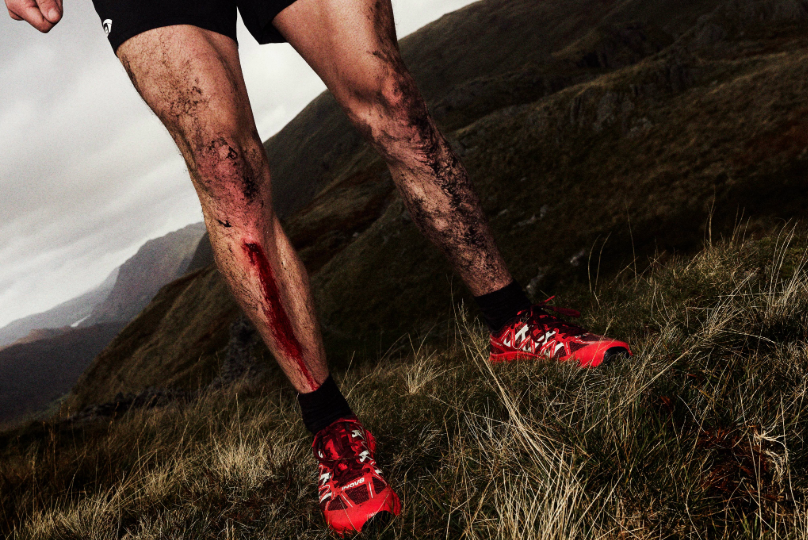 A runner's muddy and bloody leg from a slip, with the fells in the background